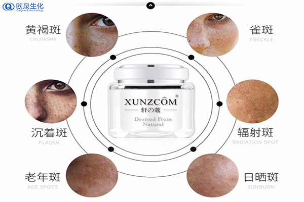 如何有效祛斑？祛斑的關(guān)鍵是什么-歐泉生化